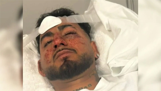 Indian assaulted